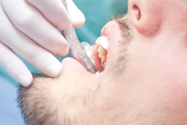 Учасники АТО у Чернівцях зможуть безкоштовно полікувати зуби
