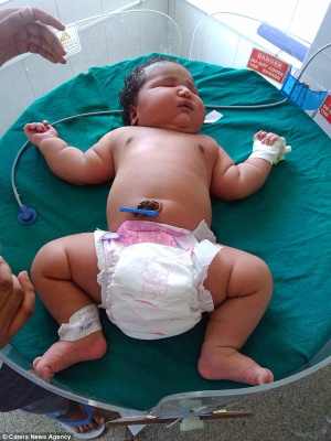 В Індії народилася дівчинка вагою майже 7 кілограмів