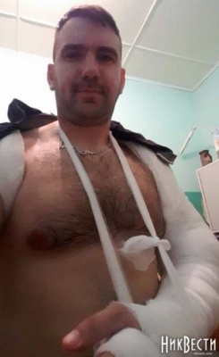 У Миколаєві два депутати побилися у сесійній залі – в одного зламана рука