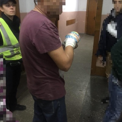На Буковині чоловік поранив руку циркуляркою: поліція допомогла його доставити в лікарню