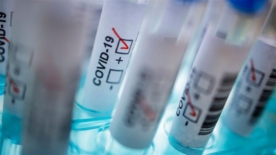 Симптоми ГРВІ є підставою для тестування на коронавірус — Ляшко