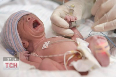 В США жінка за раз народила 4-х однакових малюків