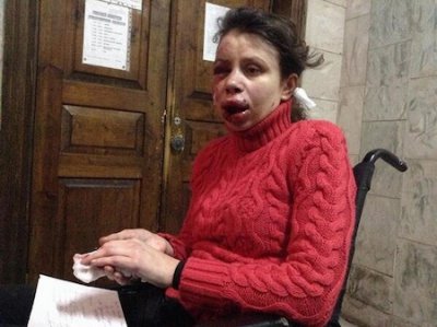 Невідомі побили журналістку, активістку Євромайдану Тетяну Чорновіл