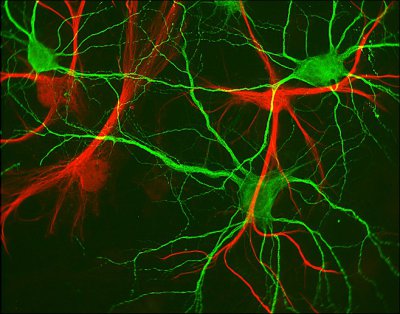 Учені: нервові клітини відновлюються
