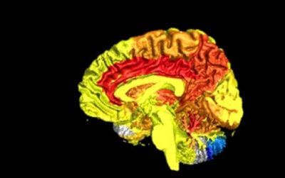 Вчені з США виявили нові відмінності в роботі мозку чоловіків і жінок