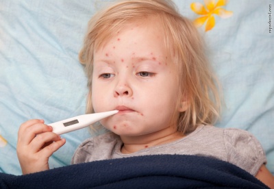 Проти кору на Буковині вакцинували 15 тисяч дітей