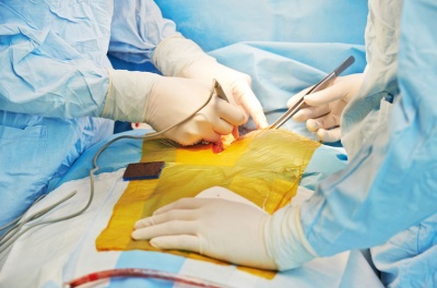 Нардепи ухвалили закон про трансплантацію органів після смерті донора