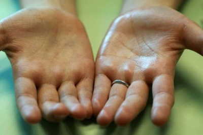 Як ваші руки сигналізують про проблеми зі здоров’ям