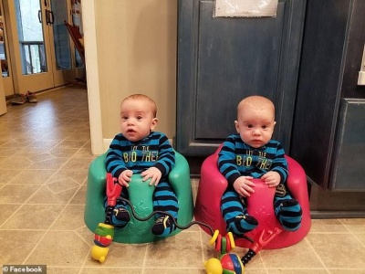 У США близнюки народилися з різницею у 15 років