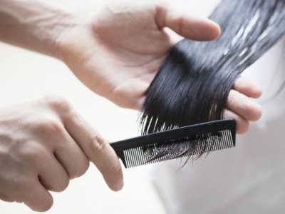 Чому випадає волосся: назвали головні причини