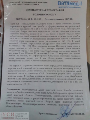 3-річний хлопчик з Чернівців випав з вікна 2 поверху, дитина у важкому стані