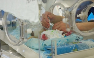 Сіамські близнюки у Чернівцях: медики провели консиліум