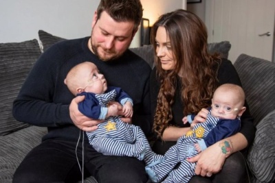 Жінка народила найменших у світі близнюків: зворушливі фото