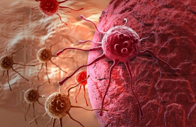 Чотири найбільш очевидні симптоми раку, які не можна терпіти