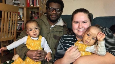 В Уельсі недоношене немовля врятували обійми брата-близнюка