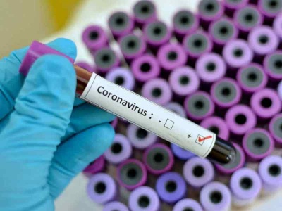 У Німеччині підтвердили перший випадок коронавірусу