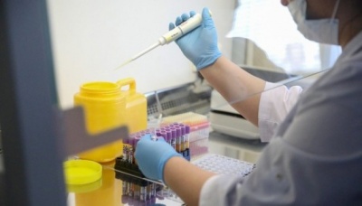 Осачук повідомив, коли на Буковину можуть привезти тест-системи для виявлення коронавірусу