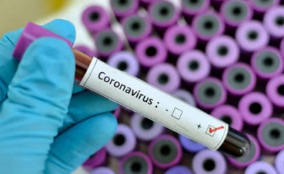 "Коли тобі кажуть: в тебе - вірус… Ти не розумієш, що далі": розповідь чернівчанина, який першим захворів на коронавірус