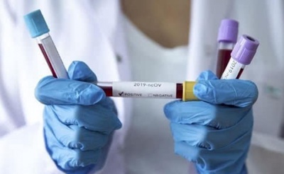 У Чернівецькій ОДА спростували інформацію про вісім буковинців, які одужали від коронавірусу