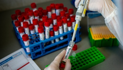 За добу на Буковині виявили понад 80 нових випадків коронавірусу