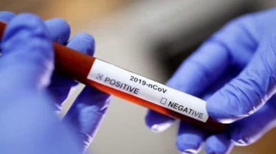 В Україні вже понад вісім тисяч випадків зараження коронавірусом