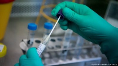 Тести на коронавірус: як їх роблять і скільки коштують у лабораторіях Чернівців