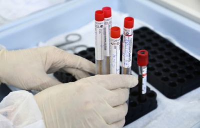На Буковині збільшилась кількість випадків коронавірусу: останні дані