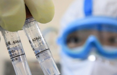 В яких селах і містах Буковини виявили нові випадки коронавірусу