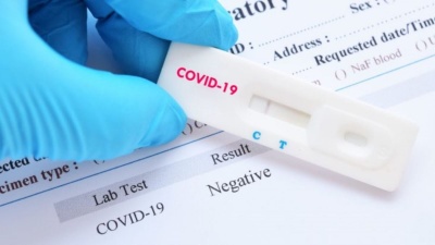 На Буковині вже другу добу виявляють рекордно низьку кількість нових хворих на COVID-19 