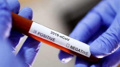 COVID-19 на Буковині: за добу виявили 23 нові випадки коронавірусу