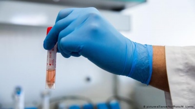 Новий рекорд: на Буковині за добу одужали від коронавірусу 134 людини