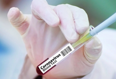 Вакцина від коронавіруса призначена для 20% українців – Ляшко
