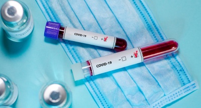 На Буковині за минулу добу померли двоє пацієнтів з коронавірусом