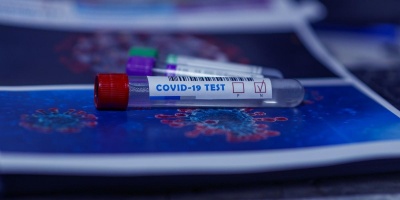 За добу на Буковині виявили 147 нових випадків коронавірусу