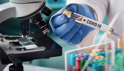 Пандемія COVID-19. У світі зафіксували вже понад 31 мільйон захворювань