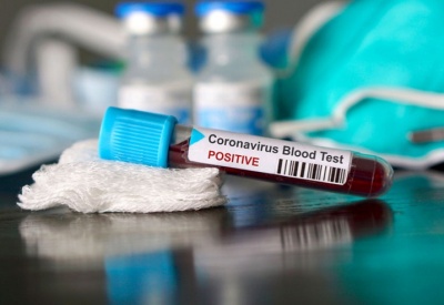 Коронавірус на Буковині: нові випадки захворювання