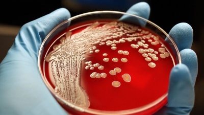Важливе відкриття, яке допоможе боротись з бактеріями без антибіотиків