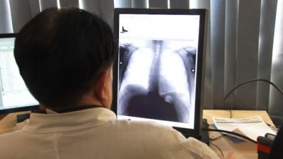 У Хотинській лікарні зламався флюорограф: черги людей шукають, де можна обстежитись