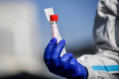 Коронавірус лютує: на Буковині знову виявили значну кількість нових випадків хвороби