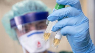 Коронавірус на Буковині: скільки нових випадків хвороби виявили медики за добу