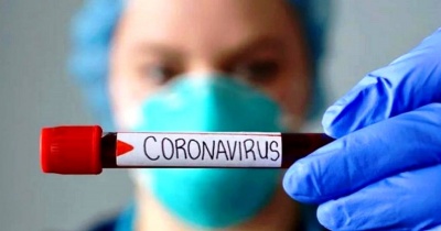 Минулої доби до лікарень через коронавірус госпіталізували 58 буковинців