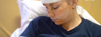 Закрила немовля своїм тілом: киянці, яка врятувала двотижневу доньку під час вибухів, наклали 25 швів